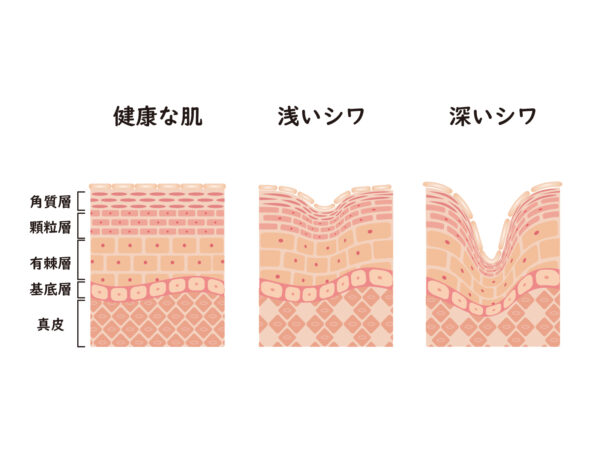 シンピストの有効成分ナイアシンアミド